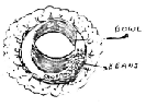 Middle Wreath Graphic